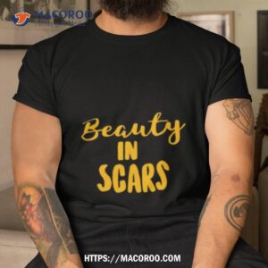 Original Beauty In Scars Shirt